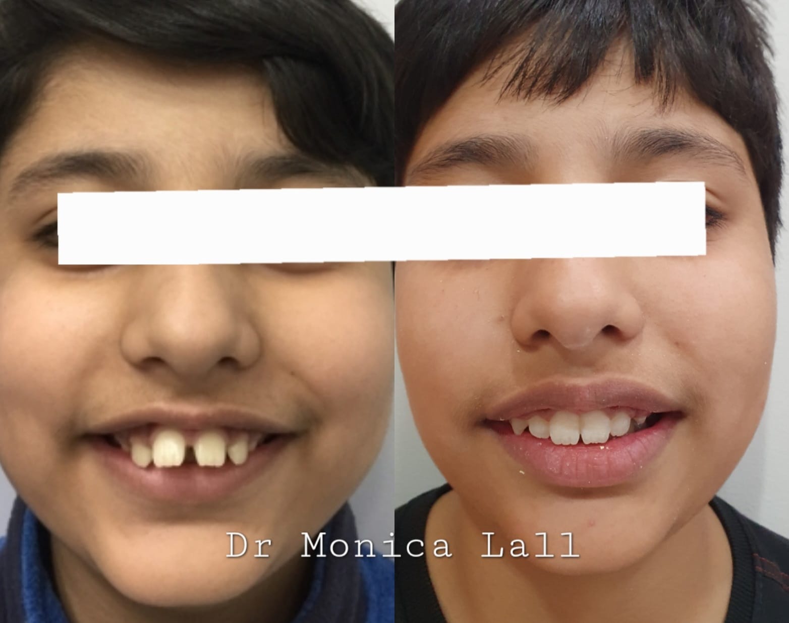Dental Transformation
